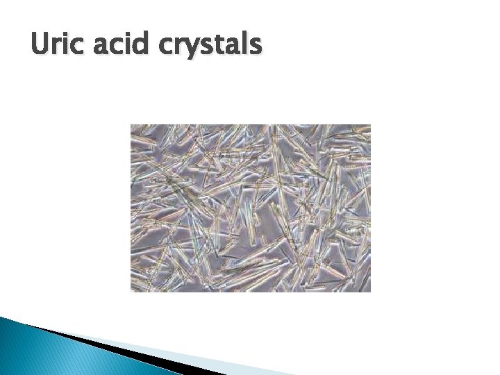 Uric acid crystals 
