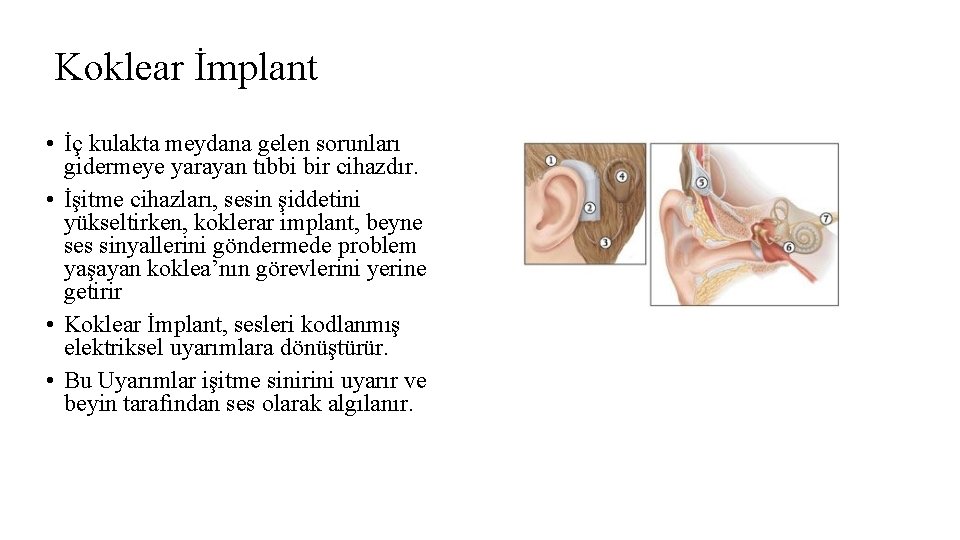 Koklear İmplant • İç kulakta meydana gelen sorunları gidermeye yarayan tıbbi bir cihazdır. •