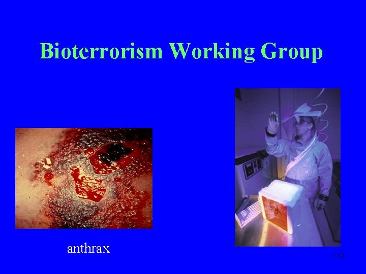Bioterrorism Working Group anthrax 110 