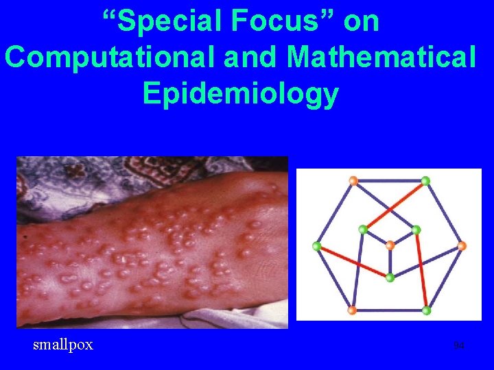 “Special Focus” on Computational and Mathematical Epidemiology smallpox 94 