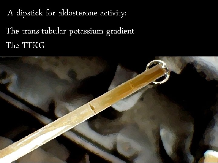 A dipstick for aldosterone activity: The trans-tubular potassium gradient The TTKG 