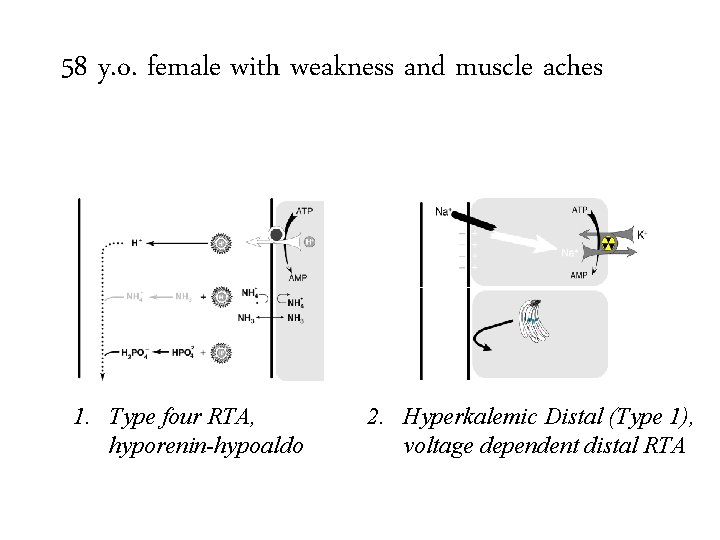 58 y. o. female with weakness and muscle aches 1. Type four RTA, hyporenin-hypoaldo