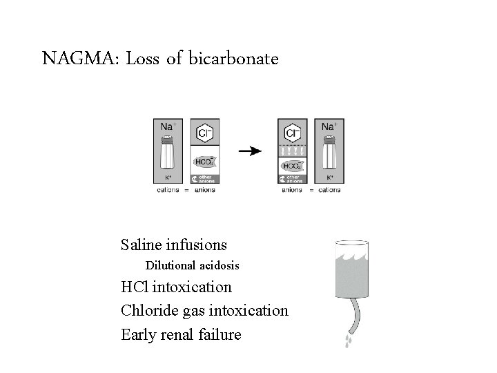 NAGMA: Loss of bicarbonate Saline infusions GI loss of HCO 3 Renal loss of