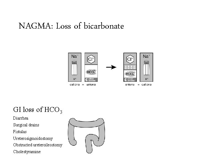 NAGMA: Loss of bicarbonate GI loss of HCO 3 Renal loss of HCO 3