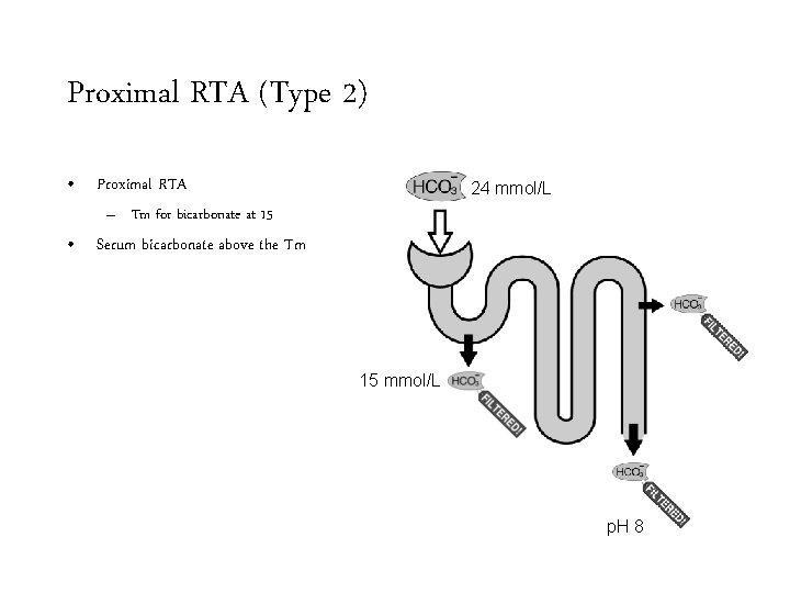 Proximal RTA (Type 2) • Proximal RTA 24 mmol/L – Tm for bicarbonate at