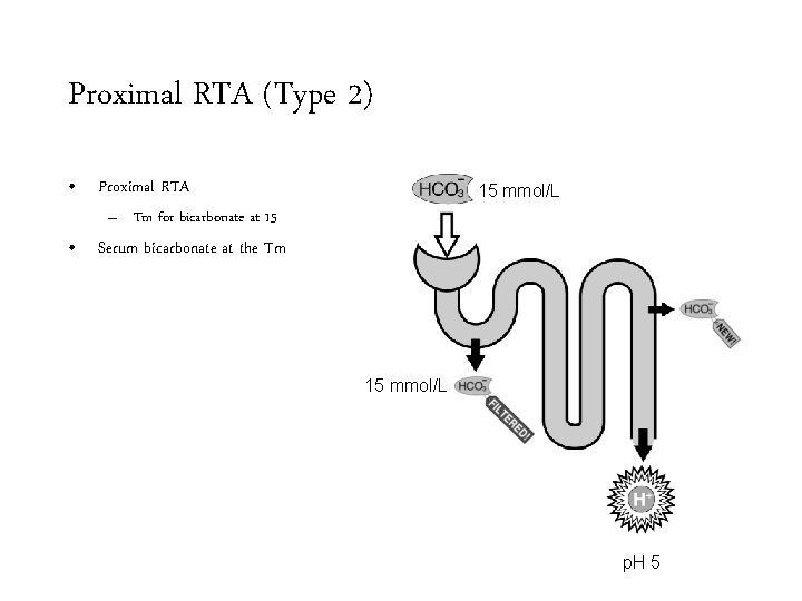 Proximal RTA (Type 2) • Proximal RTA 15 mmol/L – Tm for bicarbonate at