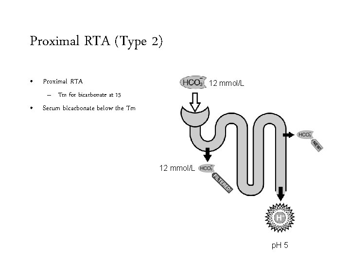 Proximal RTA (Type 2) • Proximal RTA 12 mmol/L – Tm for bicarbonate at