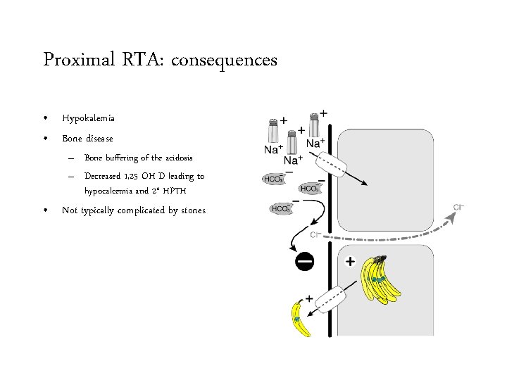 Proximal RTA: consequences • Hypokalemia • Bone disease – Bone buffering of the acidosis