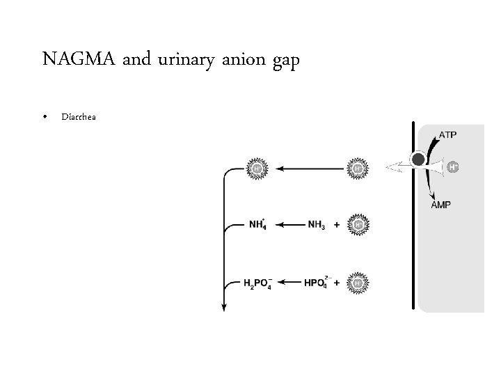 NAGMA and urinary anion gap • Diarrhea 