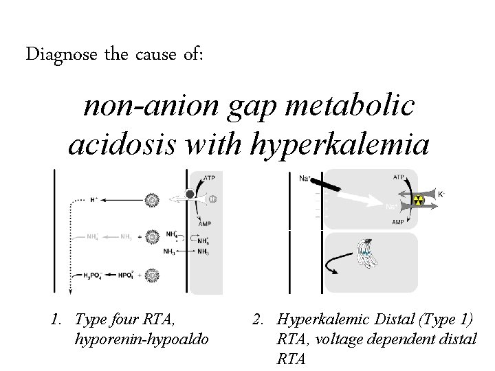 Diagnose the cause of: non-anion gap metabolic acidosis with hyperkalemia 1. Type four RTA,