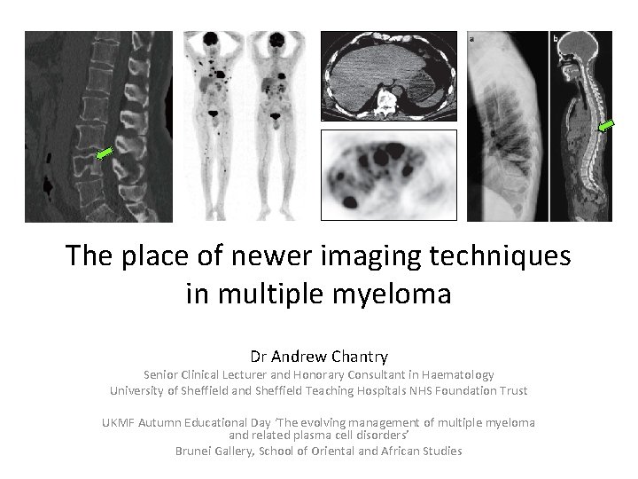 The place of newer imaging techniques in multiple