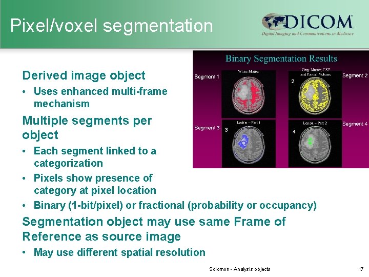 Pixel/voxel segmentation Derived image object • Uses enhanced multi-frame mechanism Multiple segments per object