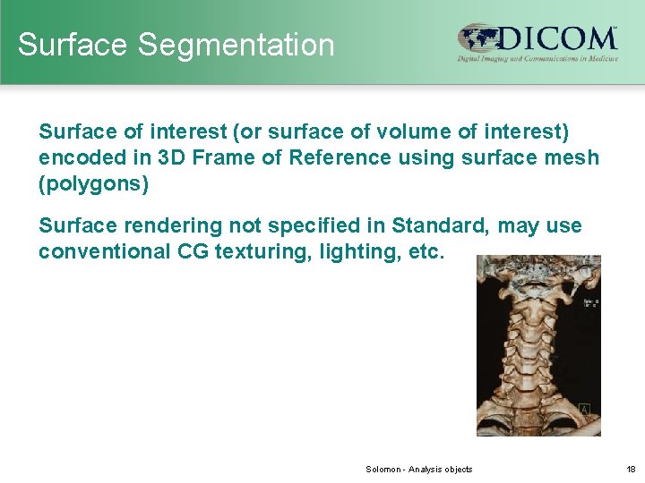 Surface Segmentation Surface of interest (or surface of volume of interest) encoded in 3