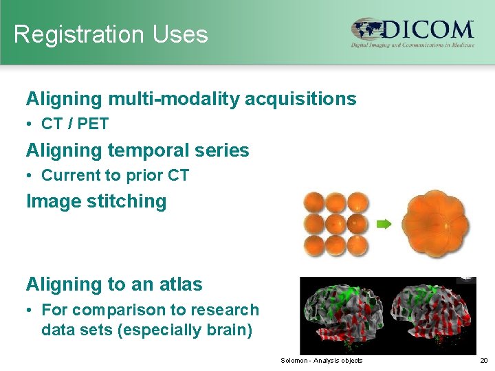 Registration Uses Aligning multi-modality acquisitions • CT / PET Aligning temporal series • Current