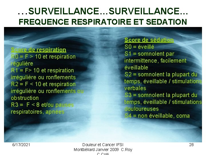 …SURVEILLANCE… FREQUENCE RESPIRATOIRE ET SEDATION Score de respiration R 0 = F > 10