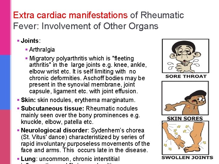 Extra cardiac manifestations of Rheumatic Fever: Involvement of Other Organs § Joints: § Arthralgia Extra cardiac manifestations of Rheumatic Fever: Involvement of Other Organs § Joints: § Arthralgia
