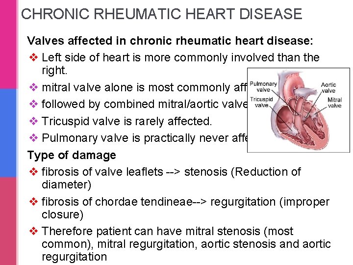 CHRONIC RHEUMATIC HEART DISEASE Valves affected in chronic rheumatic heart disease: v Left side CHRONIC RHEUMATIC HEART DISEASE Valves affected in chronic rheumatic heart disease: v Left side
