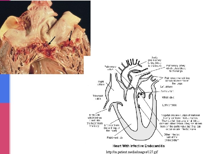 http: //m. patient. media/images/127. gif http: //m. patient. media/images/127. gif