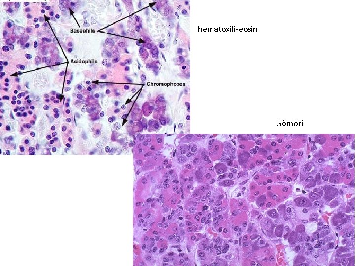 hematoxili-eosin Gömöri hematoxili-eosin Gömöri
