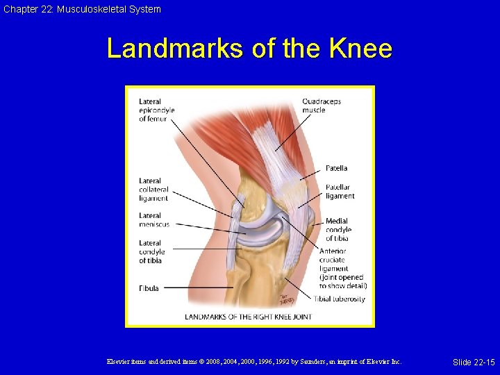 Chapter 22: Musculoskeletal System Landmarks of the Knee Elsevier items and derived items ©