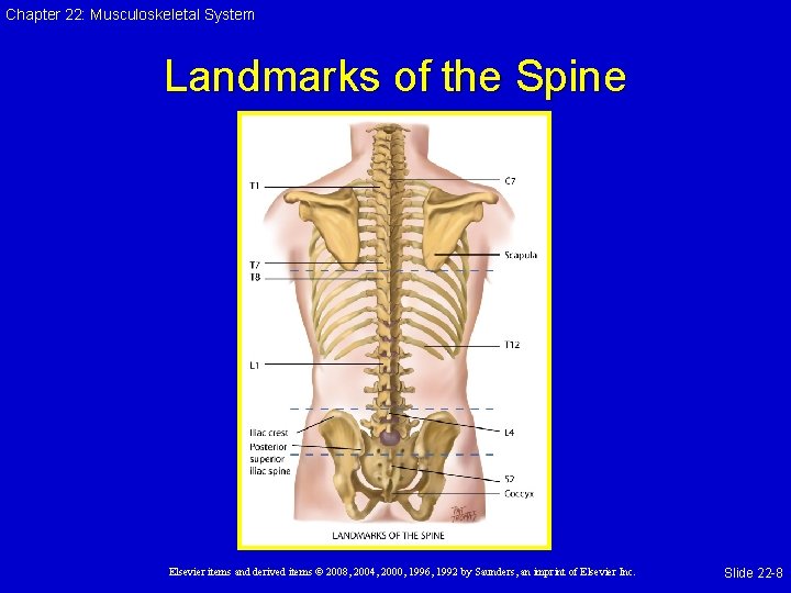 Chapter 22: Musculoskeletal System Landmarks of the Spine Elsevier items and derived items ©