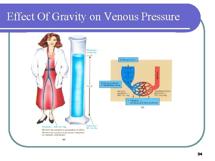 Effect Of Gravity on Venous Pressure 34 Effect Of Gravity on Venous Pressure 34