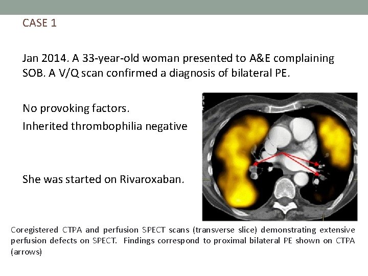 CASE 1 Jan 2014. A 33 -year-old woman presented to A&E complaining SOB. A CASE 1 Jan 2014. A 33 -year-old woman presented to A&E complaining SOB. A