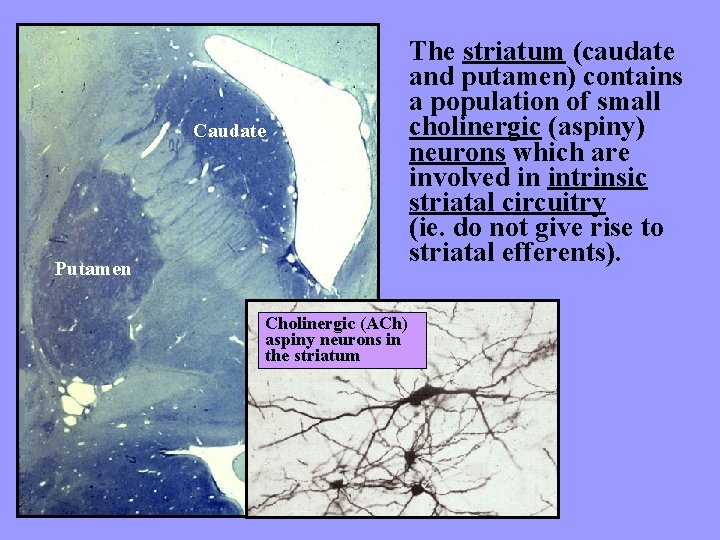 Caudate Putamen Cholinergic (ACh) aspiny neurons in the striatum The striatum (caudate and putamen)