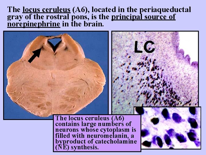 The locus ceruleus (A 6), located in the periaqueductal gray of the rostral pons,