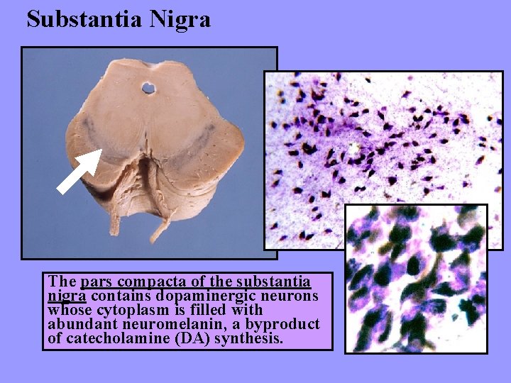 Substantia Nigra The pars compacta of the substantia nigra contains dopaminergic neurons whose cytoplasm