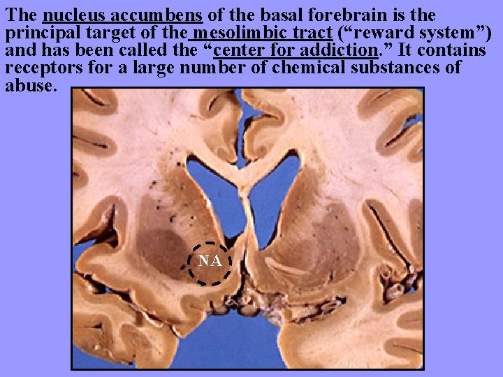 The nucleus accumbens of the basal forebrain is the principal target of the mesolimbic