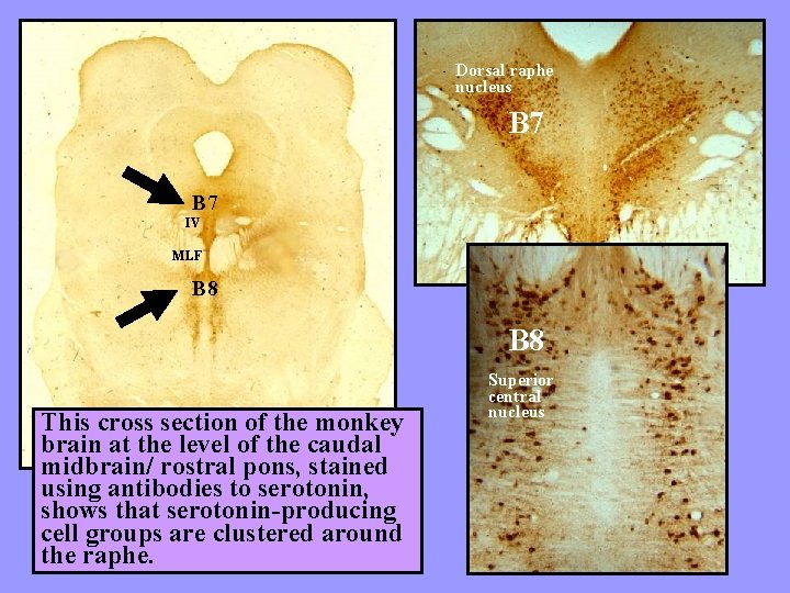 Dorsal raphe nucleus B 7 IV MLF B 8 This cross section of the