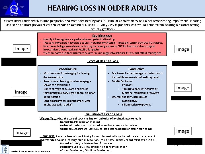 HEARING LOSS IN OLDER ADULTS It is estimated that over 6 million people 65