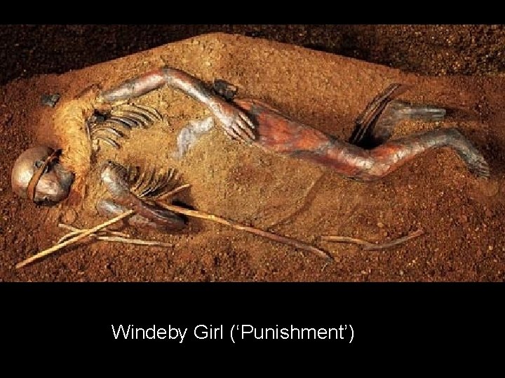 Windeby Girl (‘Punishment’) 