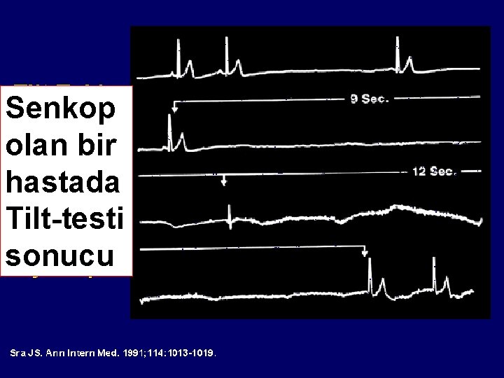 Senkop olan bir hastada Tilt-testi sonucu 