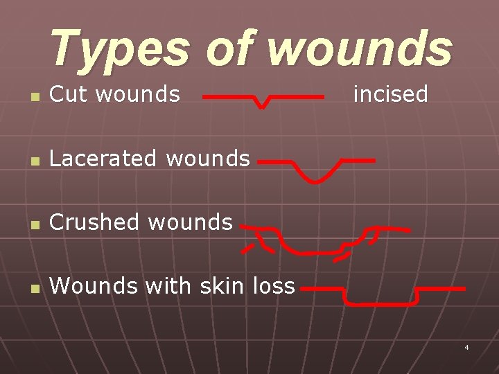 Types of wounds n Cut wounds n Lacerated wounds n Crushed wounds n Wounds