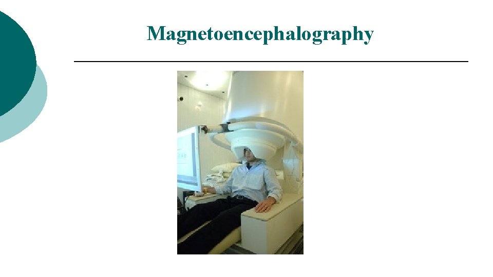 Magnetoencephalography 