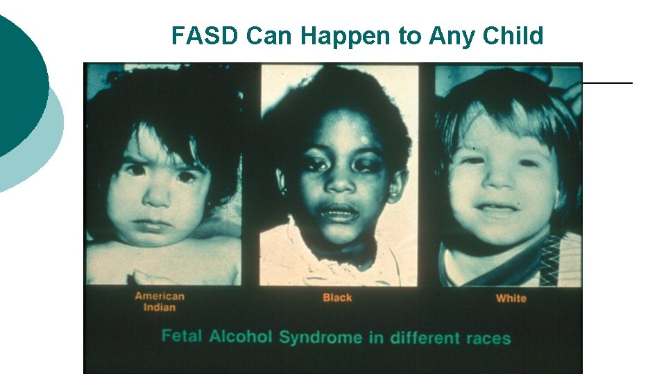 FASD Can Happen to Any Child 
