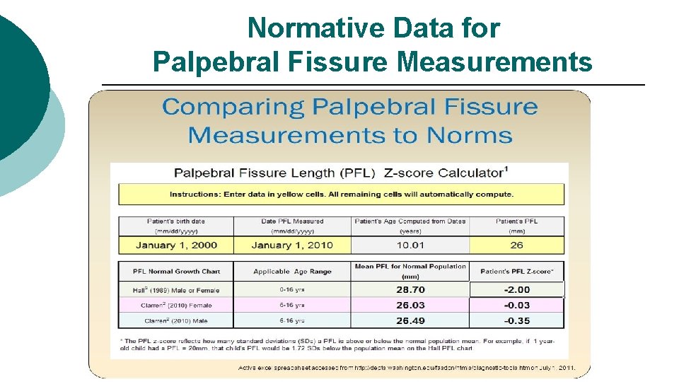 Normative Data for Palpebral Fissure Measurements 