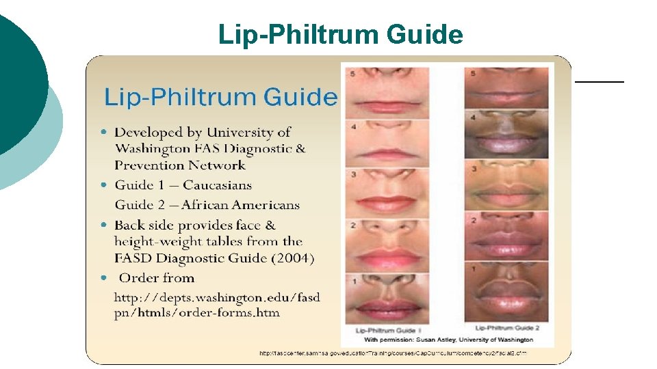 Lip-Philtrum Guide 