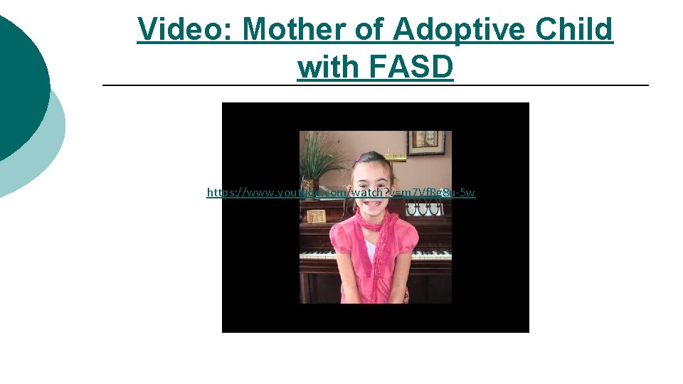Video: Mother of Adoptive Child with FASD https: //www. youtube. com/watch? v=m 7 Vf.
