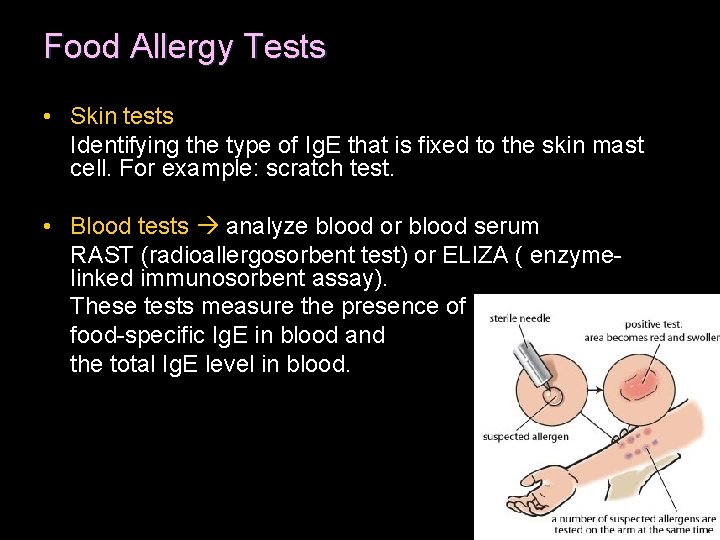 Food Allergy Tests • Skin tests Identifying the type of Ig. E that is