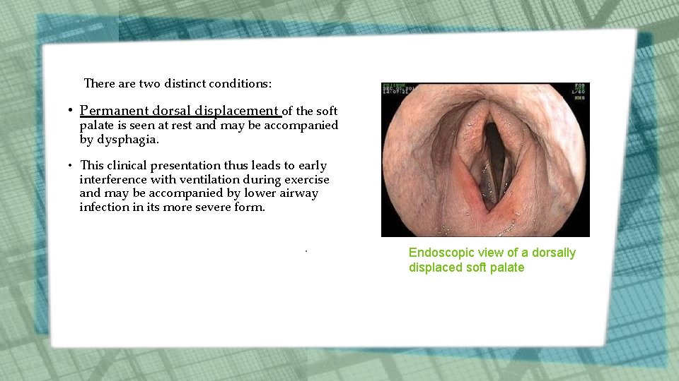 There are two distinct conditions: • Permanent dorsal displacement of the soft palate is There are two distinct conditions: • Permanent dorsal displacement of the soft palate is