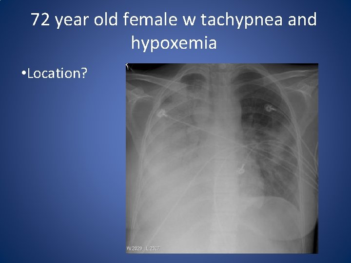 72 year old female w tachypnea and hypoxemia • Location? 