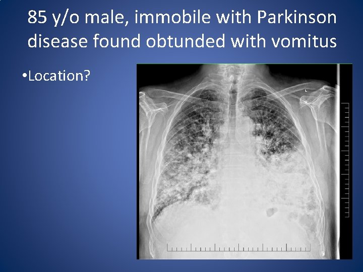85 y/o male, immobile with Parkinson disease found obtunded with vomitus • Location? 