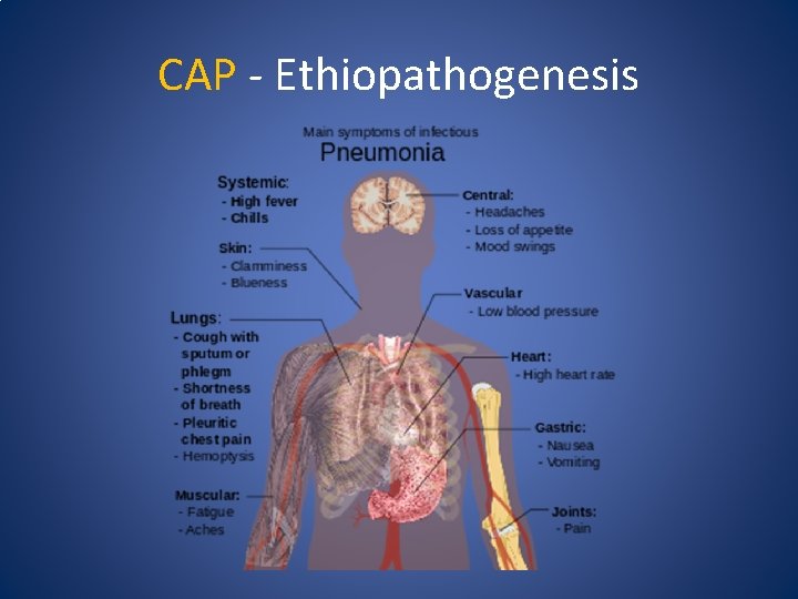 CAP - Ethiopathogenesis 