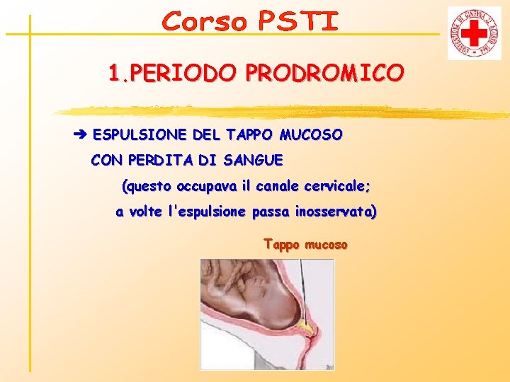 1. PERIODO PRODROMICO ➔ ESPULSIONE DEL TAPPO MUCOSO CON PERDITA DI SANGUE (questo occupava