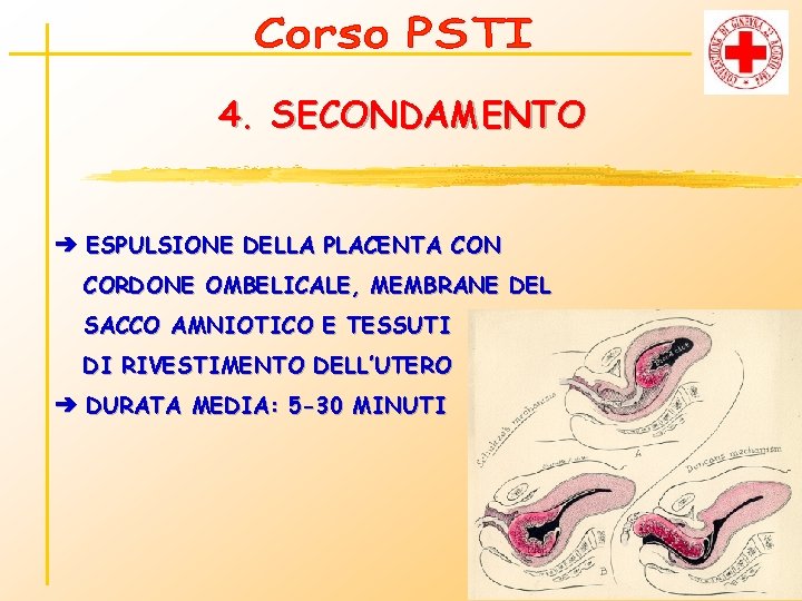 4. SECONDAMENTO ➔ ESPULSIONE DELLA PLACENTA CON CORDONE OMBELICALE, MEMBRANE DEL SACCO AMNIOTICO E