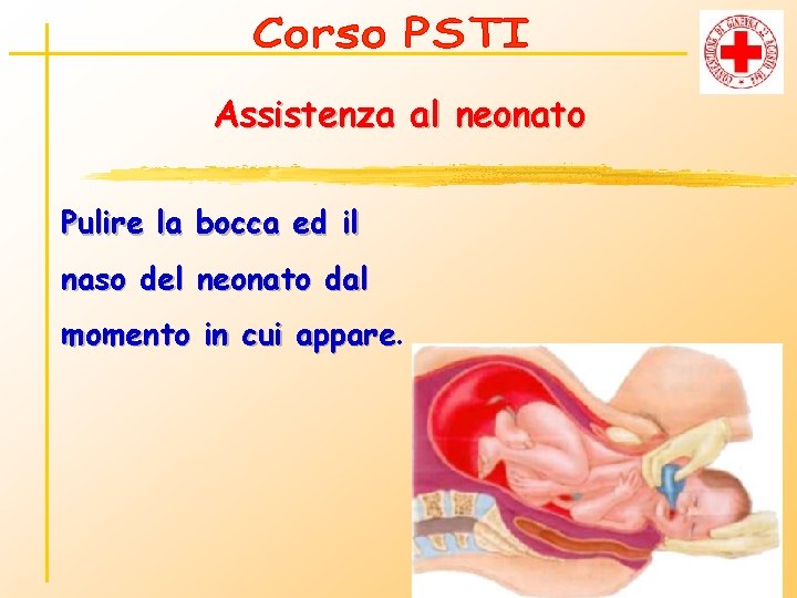 Assistenza al neonato Pulire la bocca ed il naso del neonato dal momento in