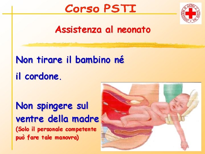 Assistenza al neonato Non tirare il bambino né il cordone. Non spingere sul ventre